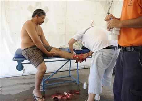 A man is treated after he was bit by a palometa, a type of piranha, while wading in the Parana River in Rosario, Argentina, Wednesday, Dec. 25, 2013. (AP Photo/La Capital, Silvina Salinas)