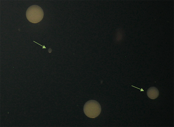 Figure 3. The larger eggs are ~120 microns in diameter. Note that 2 eggs are much smaller. Is this a case of premature egg release? Eggs are reflecting light in this photo, giving them a whitish appearance.