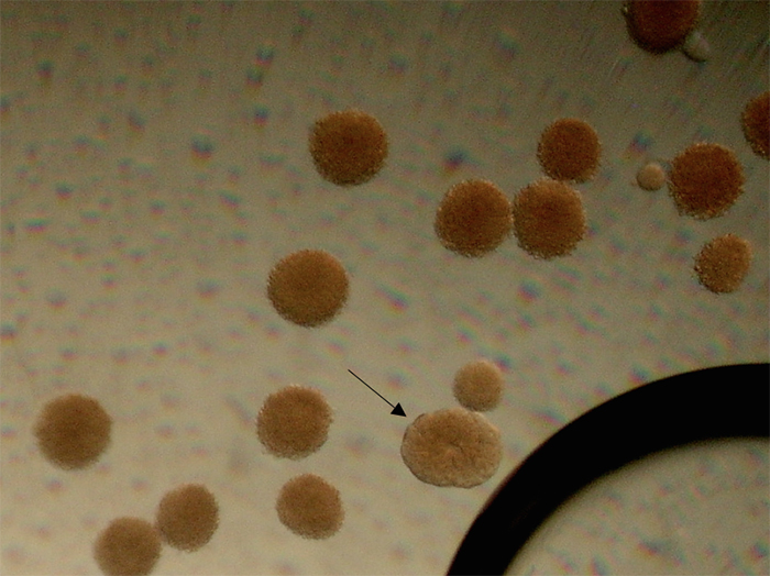 Figure 5. One fertilized egg is undergoing division, while the others (save the tiny egg toward the right corner) were not fertilized and are starting to disintegrate. Photomicrograph by Dana Riddle.