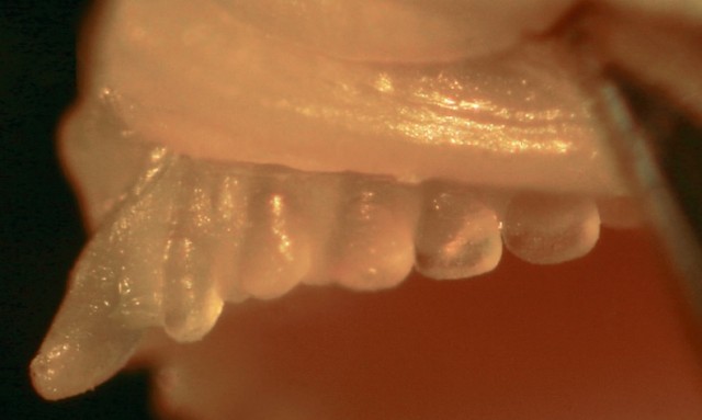 The incisiform or chisel-like teeth of Pseudojuloides. Modified from Victor et al 2013
